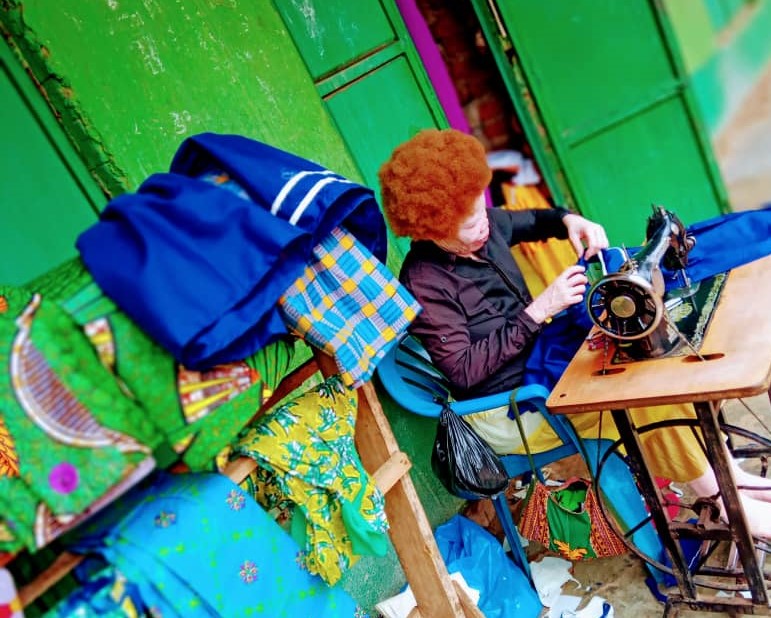 Woman with albinism working as a skilled tailor and entrepreneur